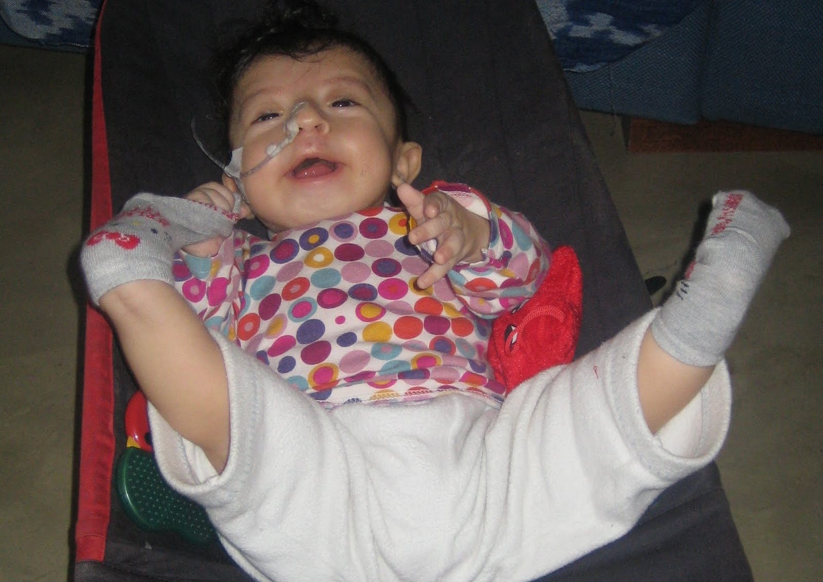 sindrome oro-facio-digitale 1 OFD1