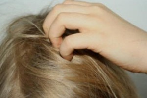 Pidocchi, se li conosci li eviti