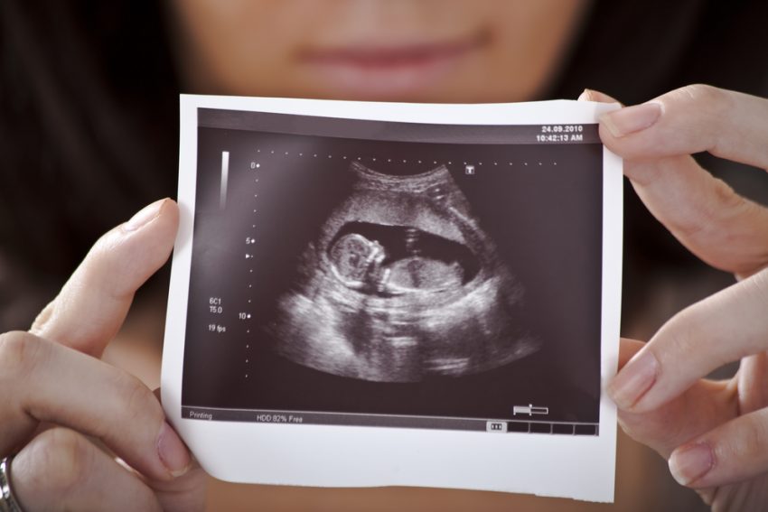 Quando Avete Fatto La Prima Ecografia